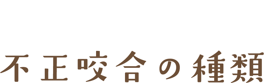 不正咬合の種類